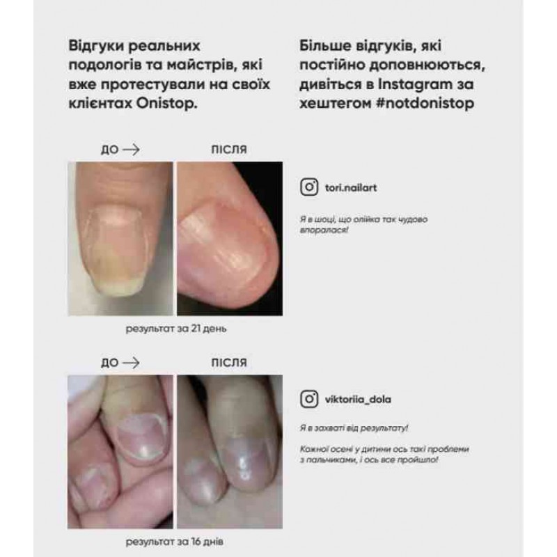 Регенерирующее масло против онихолизиса ONISTOP 8 мл NAILSOFTHEDAY