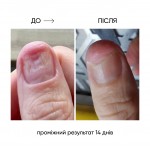 Регенерирующее масло против онихолизиса ONISTOP 15 мл NAILSOFTHEDAY